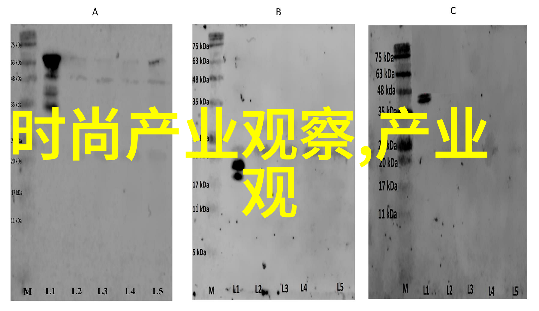 奶奶被对象咬的趣味照片集搞笑成年人与老人的互动瞬间