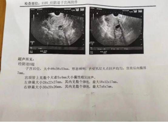 美发学徒的道路寻找理想的学习场所