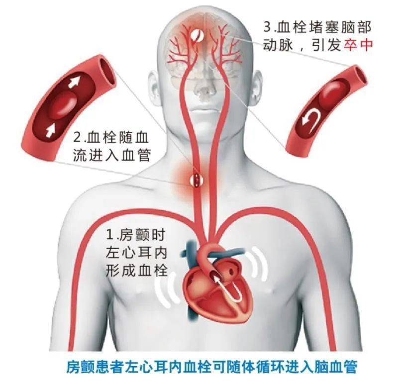 理发艺术的学问条件与要求